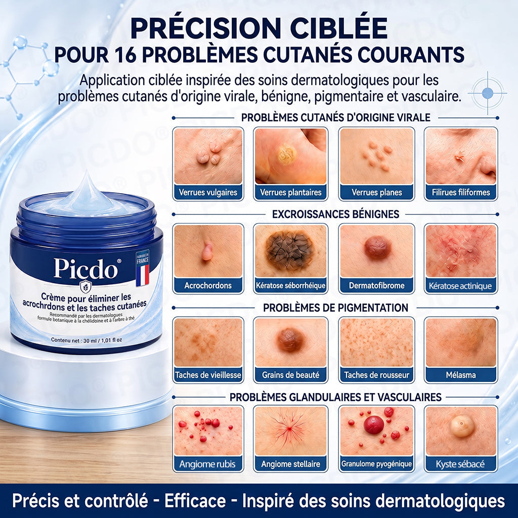 𝐏𝐢𝐜𝐝𝐨®𝐂𝐫è𝐦𝐞 𝐄𝐟𝐟𝐚𝐜𝐞𝐮𝐫 𝐝’𝐀𝐜𝐫𝐨𝐜𝐡𝐨𝐫𝐝𝐨𝐧𝐬 & 𝐝𝐞 𝐓𝐚𝐜𝐡𝐞𝐬 – 𝟕 𝐉𝐨𝐮𝐫𝐬 (𝐅𝐨𝐫𝐦𝐮𝐥𝐞 𝐙é𝐫𝐨 𝐃𝐨𝐮𝐥𝐞𝐮𝐫, 𝐙é𝐫𝐨 𝐂𝐢𝐜𝐚𝐭𝐫𝐢𝐜𝐞) 🌹