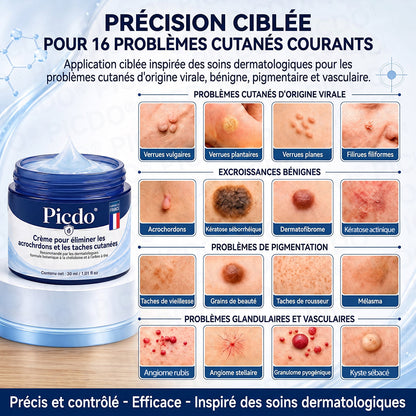 𝐏𝐢𝐜𝐝𝐨®𝐂𝐫è𝐦𝐞 𝐄𝐟𝐟𝐚𝐜𝐞𝐮𝐫 𝐝’𝐀𝐜𝐫𝐨𝐜𝐡𝐨𝐫𝐝𝐨𝐧𝐬 & 𝐝𝐞 𝐓𝐚𝐜𝐡𝐞𝐬 – 𝟕 𝐉𝐨𝐮𝐫𝐬 (𝐅𝐨𝐫𝐦𝐮𝐥𝐞 𝐙é𝐫𝐨 𝐃𝐨𝐮𝐥𝐞𝐮𝐫, 𝐙é𝐫𝐨 𝐂𝐢𝐜𝐚𝐭𝐫𝐢𝐜𝐞) 🌹