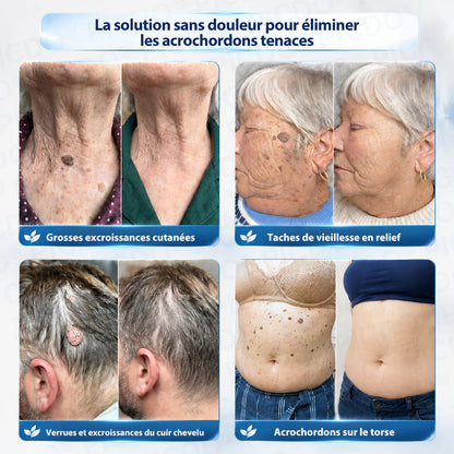 𝐏𝐢𝐜𝐝𝐨®𝐂𝐫è𝐦𝐞 𝐄𝐟𝐟𝐚𝐜𝐞𝐮𝐫 𝐝’𝐀𝐜𝐫𝐨𝐜𝐡𝐨𝐫𝐝𝐨𝐧𝐬 & 𝐝𝐞 𝐓𝐚𝐜𝐡𝐞𝐬 – 𝟕 𝐉𝐨𝐮𝐫𝐬 (𝐅𝐨𝐫𝐦𝐮𝐥𝐞 𝐙é𝐫𝐨 𝐃𝐨𝐮𝐥𝐞𝐮𝐫, 𝐙é𝐫𝐨 𝐂𝐢𝐜𝐚𝐭𝐫𝐢𝐜𝐞) 🌹