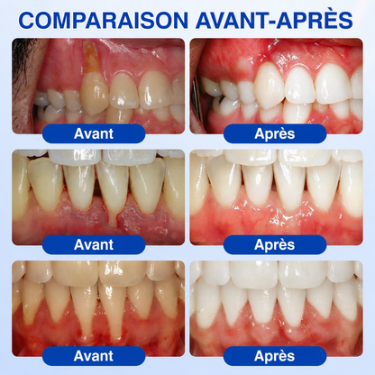 🇫🇷🏅🦷🛡️𝐋𝐮𝐱𝐚𝐫𝐢𝐬𝐞® GumRevive Gel Réparateur Parodontal