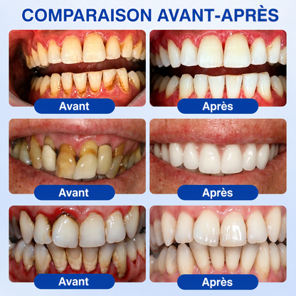 🇫🇷🏅🦷🛡️𝐋𝐮𝐱𝐚𝐫𝐢𝐬𝐞® GumRevive Gel Réparateur Parodontal
