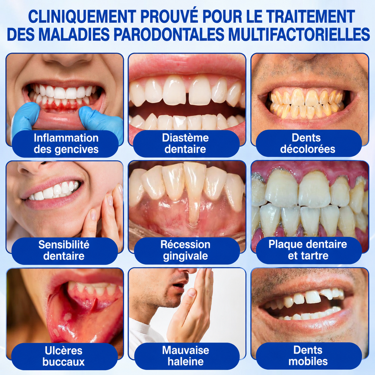 🇫🇷🏅🦷🛡️𝐋𝐮𝐱𝐚𝐫𝐢𝐬𝐞® GumRevive Gel Réparateur Parodontal