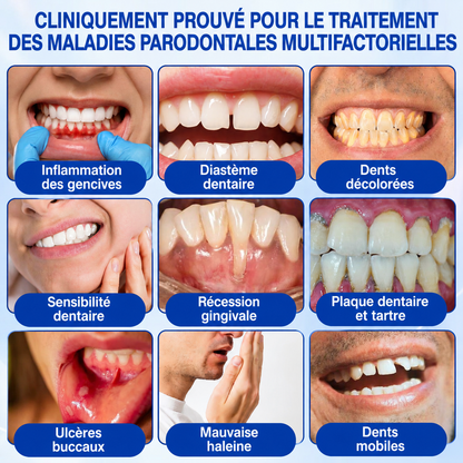 🇫🇷🏅🦷🛡️𝐋𝐮𝐱𝐚𝐫𝐢𝐬𝐞® GumRevive Gel Réparateur Parodontal