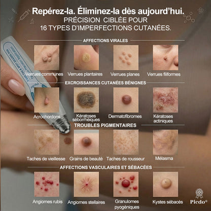 Boutique officielle de la marque |✅🎉𝐏i𝐜𝐝o® 7 Jours Effaceur de taches et d’excroissances cutanées(Zéro douleur, zéro cicatrice – Roller) ⏳