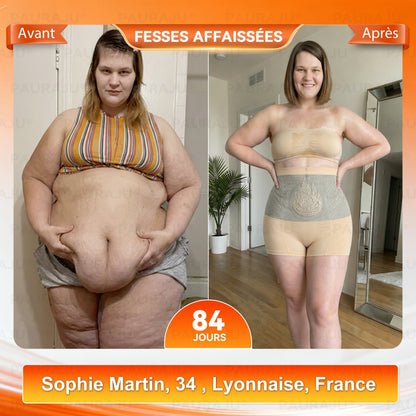 Boutique Officielle | 🧑‍⚕️ 𝐏𝐀𝐔𝐑𝐀𝐉𝐔® 2026 Short Sculptant & Brûle-Graisses 4-en-1 aux Micro-Particules de Moringa & Berbérine ✨
