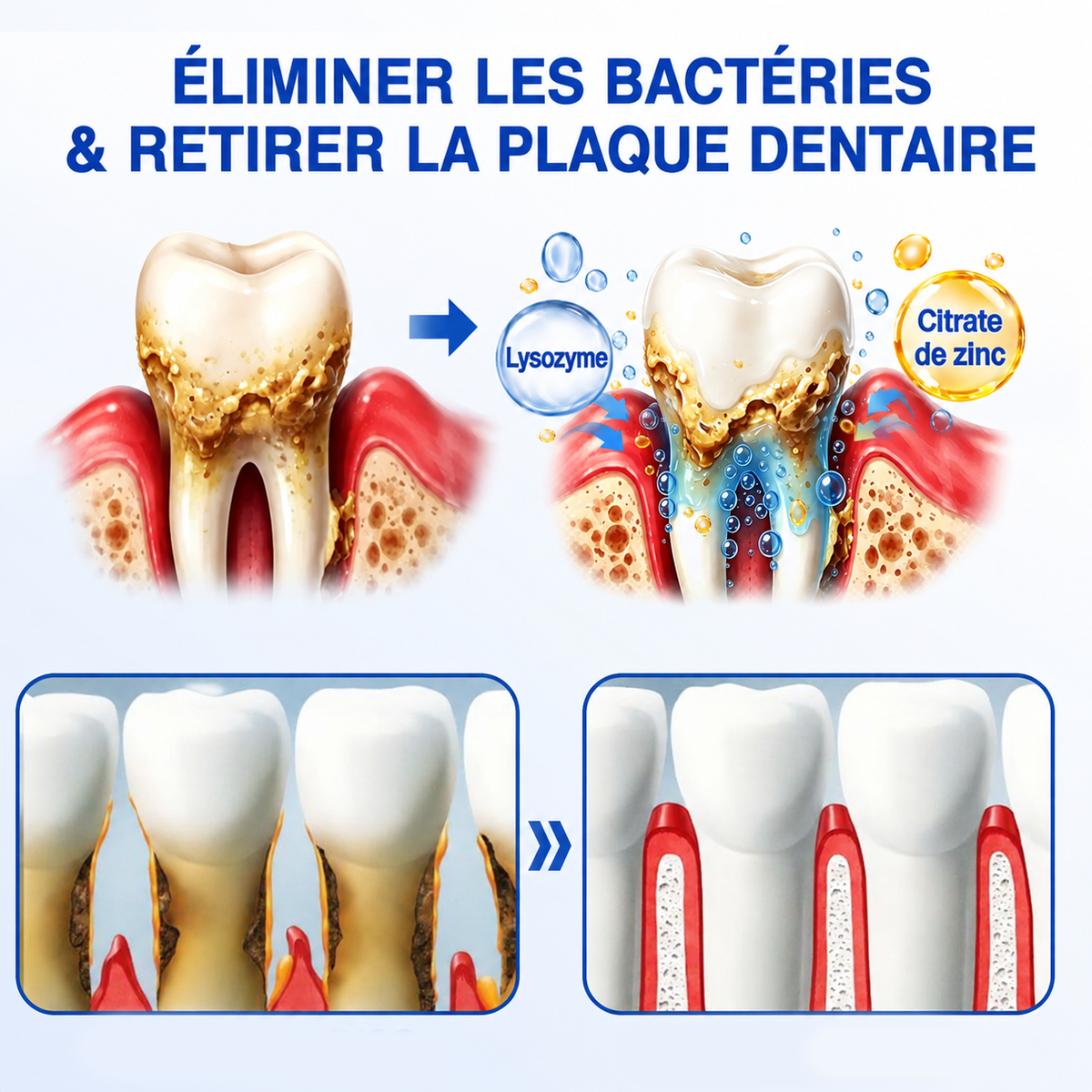 🇫🇷🏅🦷🛡️𝐋𝐮𝐱𝐚𝐫𝐢𝐬𝐞® GumRevive Gel Réparateur Parodontal