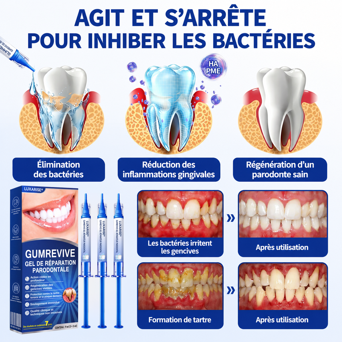 🇫🇷🏅🦷🛡️𝐋𝐮𝐱𝐚𝐫𝐢𝐬𝐞® GumRevive Gel Réparateur Parodontal